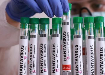 Hantavirusa görə Çilidə sanitariya həyəcanı elan edildi