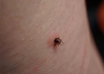 Çində gənə ilə yayılan yeni virus aşkarlanıb